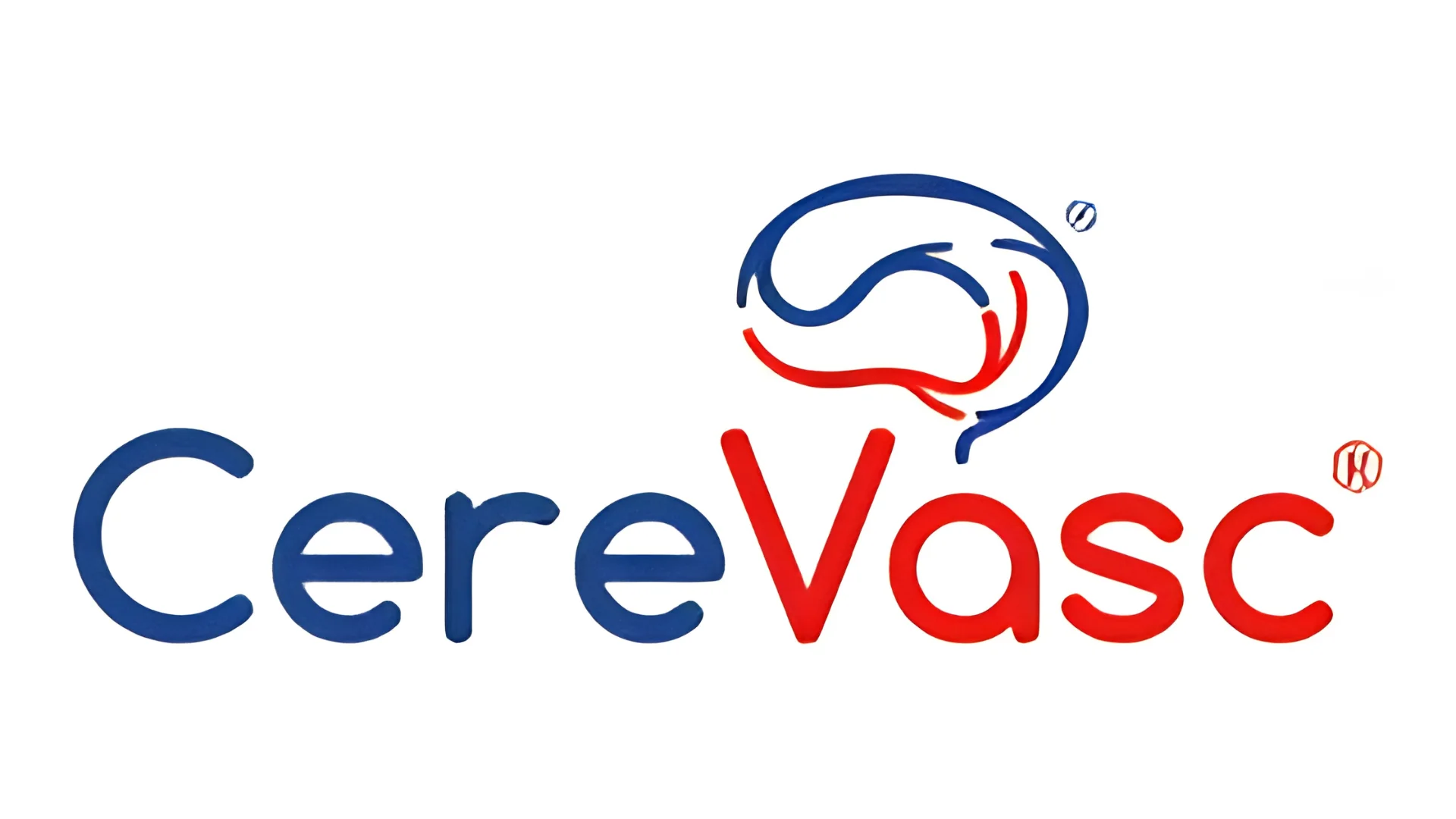 CereVasc Raises $85M Series C to Advance eShunt Hydrocephalus Treatment
